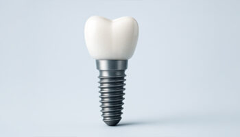 Are Dental Implants Right for You? How to Know If You’re a Good Candidate