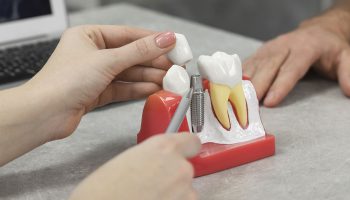 Dental Implants & Restorative Options Near Thurlow Street